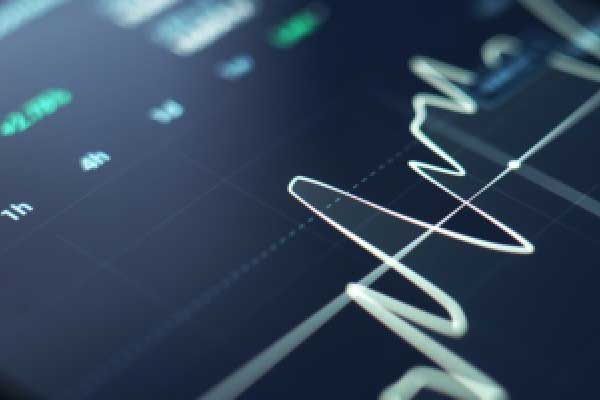 许安丰：2.24黄金日内操作策略，多头调整勇攀高峰